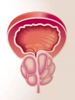 Infiammazione della prostata